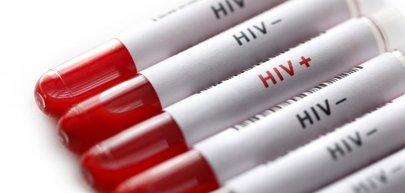 Untore dell’Hiv: il pm chiede l’ergastolo