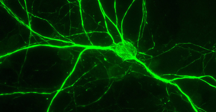 Scoperta la proteina Apache, guida del sistema nervoso