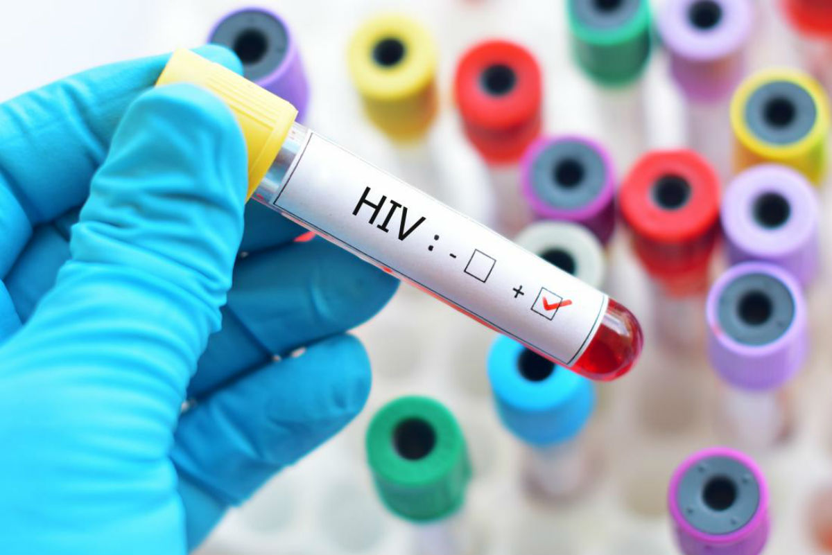 Hiv, secondo paziente guarito con trapianto staminali