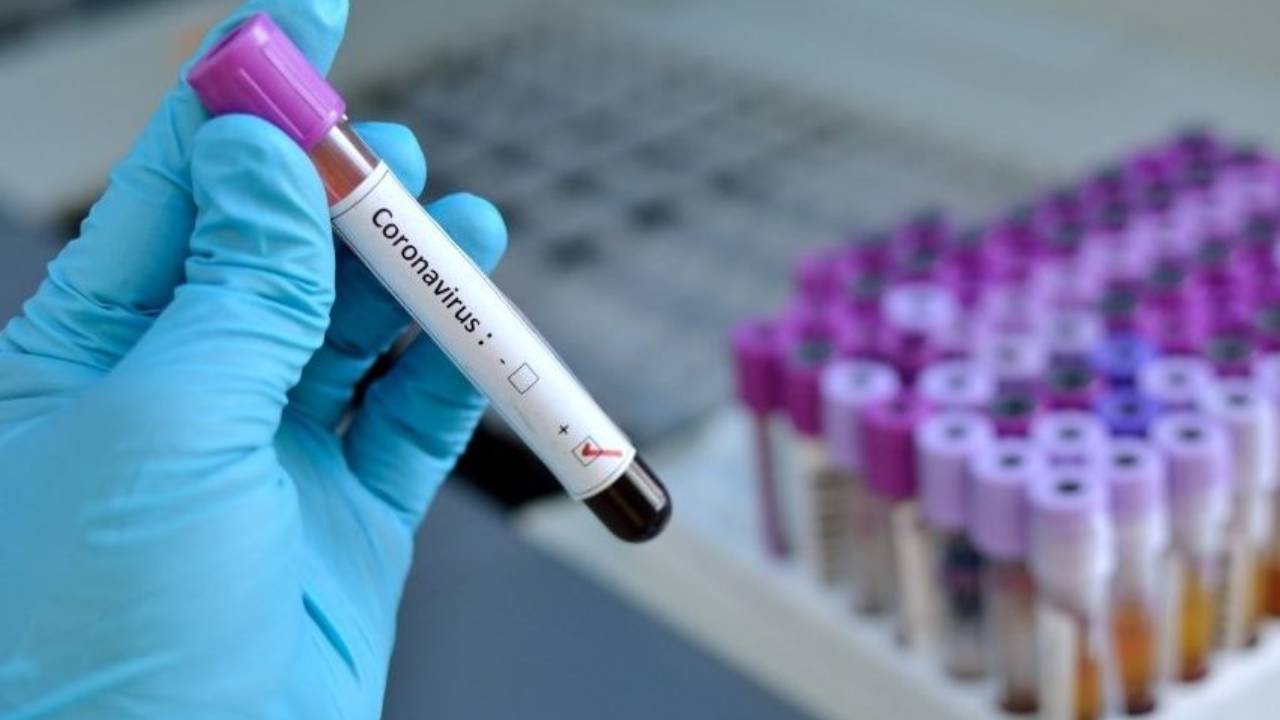 Coronavirus: la bufala dei tamponi