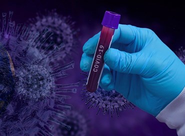 Croce rossa, 50% disponibile a test sierologici