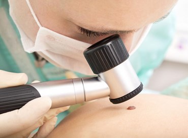 L’Opinione risponde: Epiluminescenza