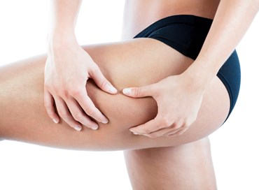 L’Opinione risponde: cellulite e fitoterapia