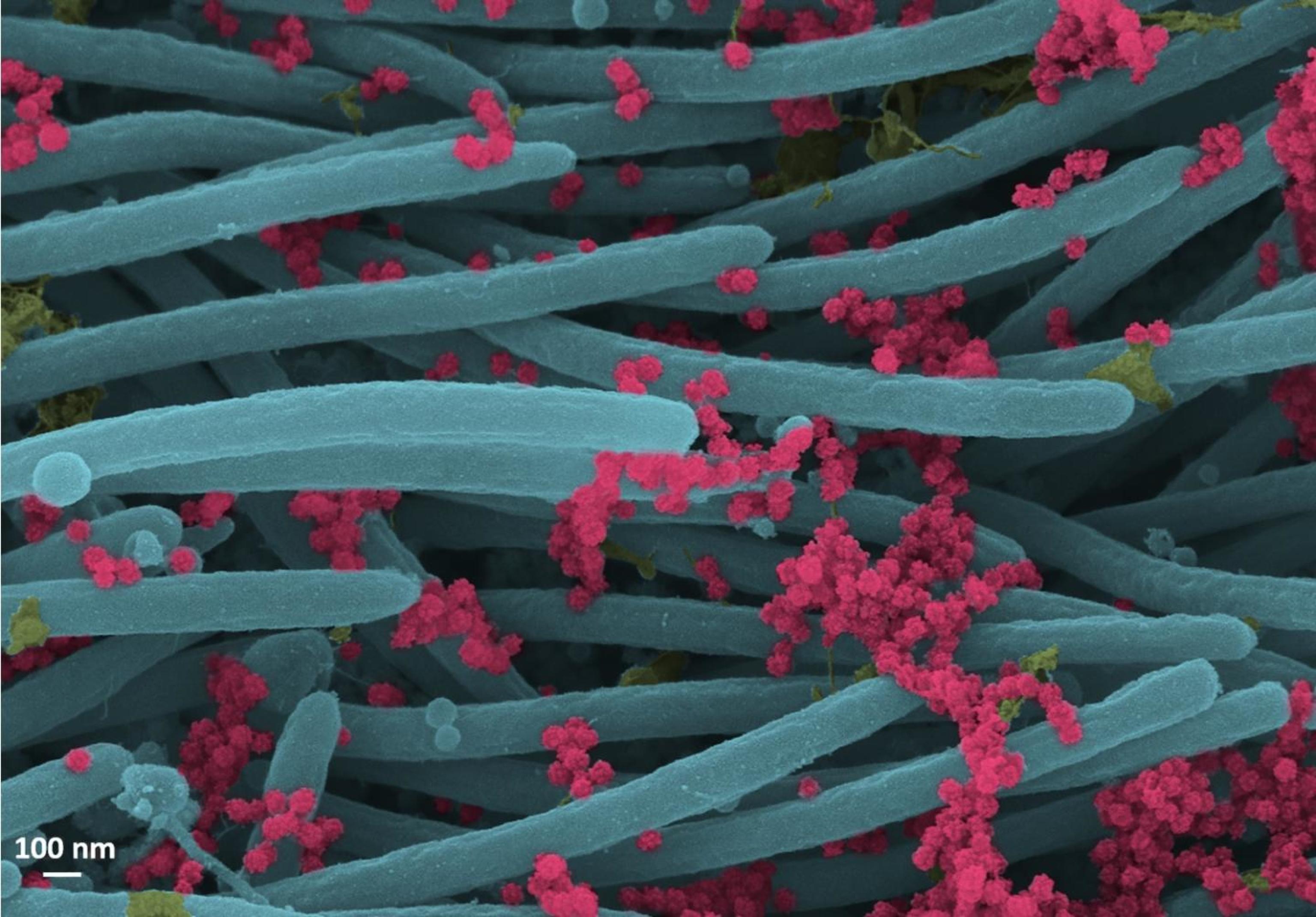 Caro Covid, scialla!