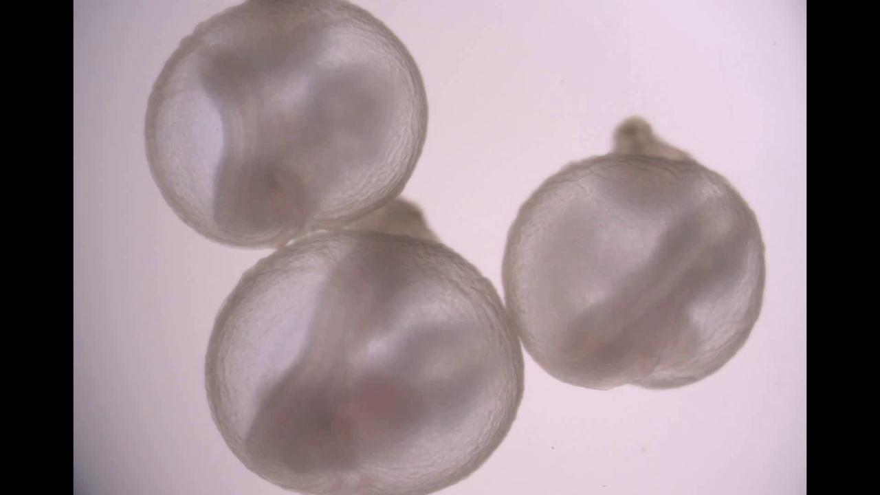 I problemi etici e giuridici dell’utero artificiale