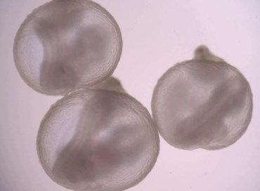 I problemi etici e giuridici dell’utero artificiale