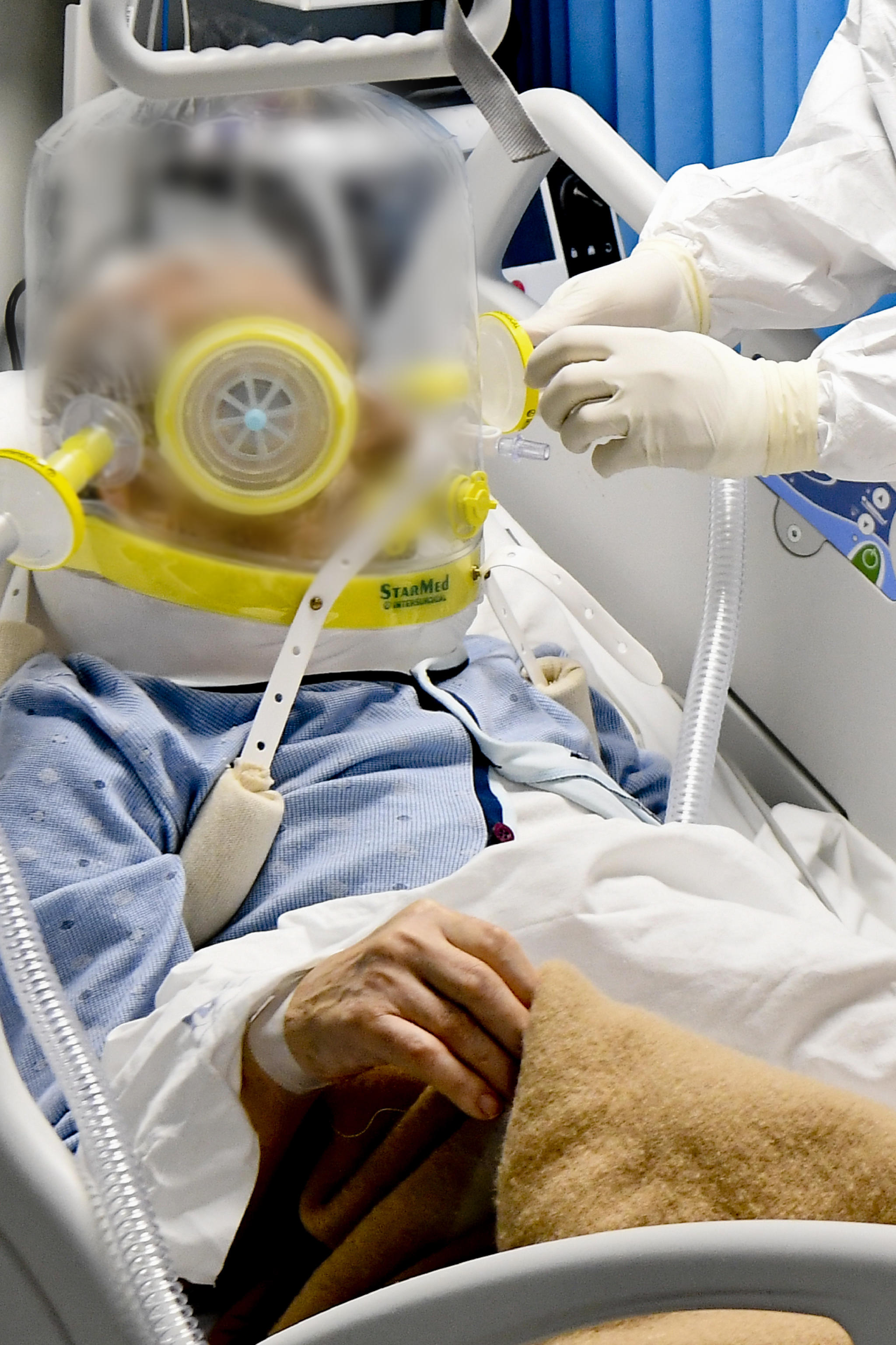 La dignità perduta dei guariti da Covid grave