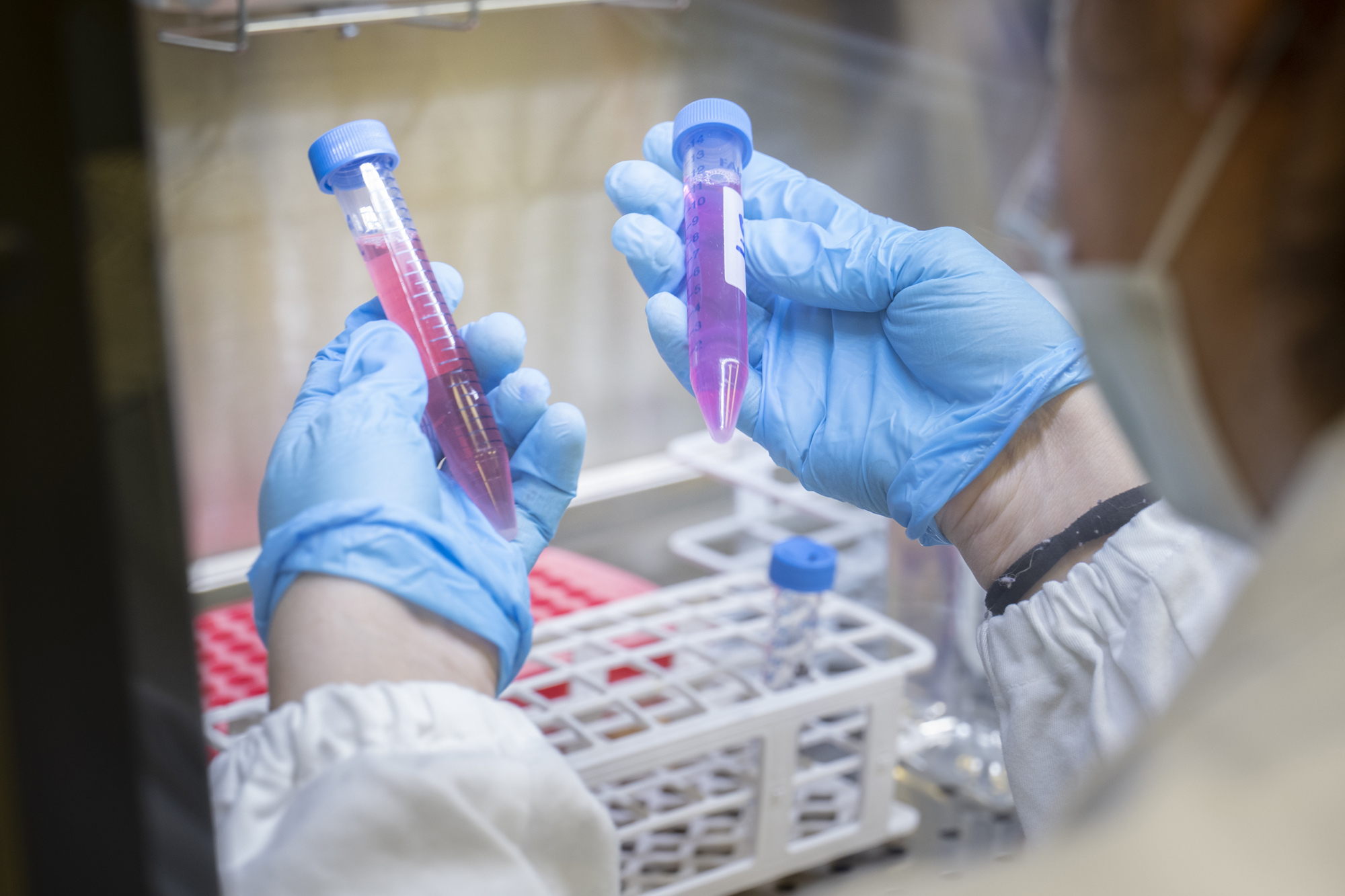 Malati “rari” senza diagnosi: oltre 100mila in Italia