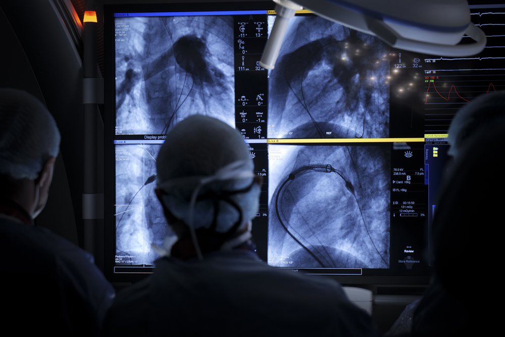 Nuova tecnologia per le protesi valvolari polmonari  