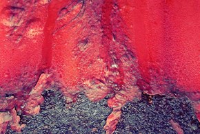 L’eruzione cutanea